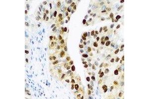 Immunohistochemical analysis of PHC1 staining in human prostate formalin fixed paraffin embedded tissue section. (PHC1 anticorps)