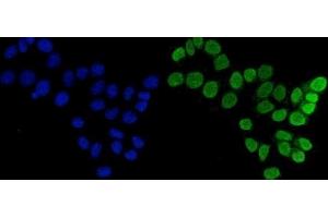 IF analysis of FEN1 using anti-FEN1 antibody (ABIN7601618). (FEN1 anticorps  (AA 4-300))