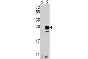 Western blot analysis of NRAS (arrow) using rabbit NRAS polyclonal antibody . (GTPase NRas anticorps  (N-Term))