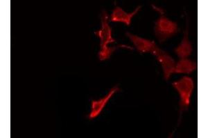 ABIN6275944 staining HeLa by IF/ICC.