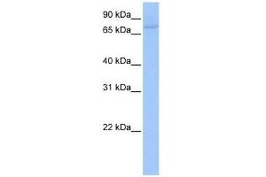 Western Blot showing ZNF440 antibody used at a concentration of 1-2 ug/ml to detect its target protein. (ZNF440 anticorps  (C-Term))