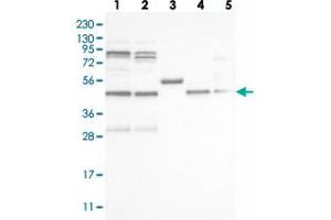 Western blot analysis of Lane 1: RT-4, Lane 2: U-251 MG, Lane 3: Human Plasma, Lane 4: Liver, Lane 5: Tonsil with VPS37A polyclonal antibody  at 1:250-1:500 dilution.
