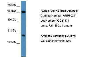 WB Suggested Anti-KBTBD8  Antibody Titration: 0.