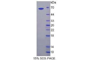 SDS-PAGE (SDS) image for Calcineurin Binding Protein 1 (CABIN1) (AA 23-288) protein (His tag,GST tag) (ABIN6239159)