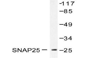 Image no. 1 for anti-Synaptosomal-Associated Protein, 25kDa (SNAP25) antibody (ABIN271818) (SNAP25 anticorps)