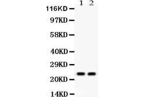 Observed bind size: 22KD (Lipocalin 2 anticorps  (AA 21-198))