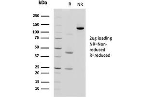 SDS-PAGE AnalysisPurified Cadherin 17 / CDH17 Mouse Monoclonal Antibody (CDH17/2618).