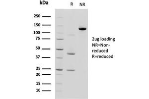 SDS-PAGE AnalysisPurified Cadherin 17 / CDH17 Mouse Monoclonal Antibody (CDH17/2618). (LI Cadherin anticorps  (AA 242-418))