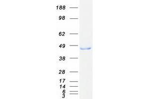 Validation with Western Blot
