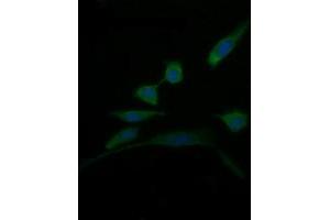 Image no. 2 for anti-D-Dopachrome Tautomerase (DDT) antibody (ABIN1497794) (DDT anticorps)
