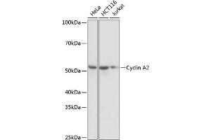 Western blot analysis of extracts of various cell lines, using Cyclin  antibody (ABIN7266551) at 1:1000 dilution. (Cyclin A anticorps)