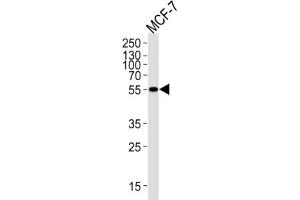 Western Blotting (WB) image for anti-Aldehyde Dehydrogenase 6 Family, Member A1 (ALDH6A1) antibody (ABIN2995317)