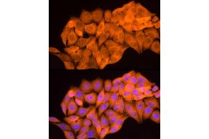Immunofluorescence analysis of HeLa cells using B1 Rabbit pAb (ABIN3022390, ABIN3022391, ABIN3022392, ABIN1512555 and ABIN6218779) at dilution of 1:50 (40x lens).