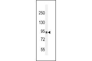 IL12RB2 Antibody (C-term) (ABIN654644 and ABIN2844340) western blot analysis in MDA-M cell line lysates (35 μg/lane). (IL12_2 (AA 756-783), (C-Term) anticorps)