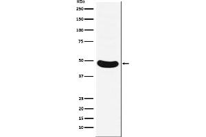 Western blot analysis of HB9/HLXB9 expression in Molt-4 cell lysate.