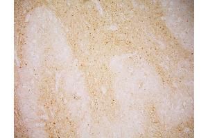 Immunohistochemistry staining of GCPII in human medulla oblongata by GCP-04 monoclonal antibody.