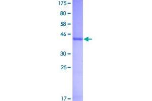 Interferon, alpha 1 (IFNA1) (AA 1-189) protein (GST tag)