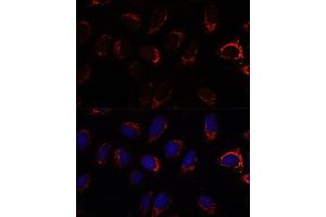 Immunofluorescence analysis of U-2 OS cells using S2 antibody (ABIN7265451) at dilution of 1:100. (AP3S2 anticorps  (AA 1-193))