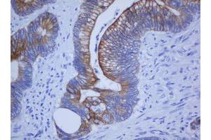 Image no. 2 for anti-Keratin 20 (KRT20) (AA 1-266) antibody (ABIN1490690) (KRT20 anticorps  (AA 1-266))