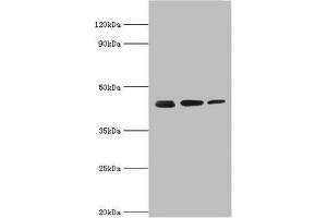 Western blot All lanes: Actin-related protein 2 antibody at 3 μg/mL Lane 1: Mouse spleen tissue Lane 2: Jurkat whole cell lysate Lane 3: MCF-7 whole cell lysate Secondary Goat polyclonal to rabbit IgG at 1/10000 dilution Predicted band size: 45, 46 kDa Observed band size: 45 kDa (ACTR2 anticorps  (AA 1-160))