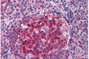 Human Tonsil (formalin-fixed, paraffin-embedded) stained with RRM2B antibody ABIN214469 at 2. (RRM2B anticorps  (AA 2-17))