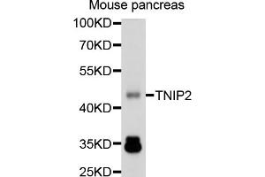 Western blot analysis of extracts of mouse pancreas, using TNIP2 antibody (ABIN1875145) at 1:1000 dilution. (TNIP2 anticorps)