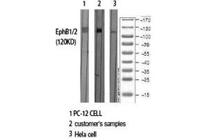 Western Blot (WB) analysis of specific cells using EphB1/2 Polyclonal Antibody.