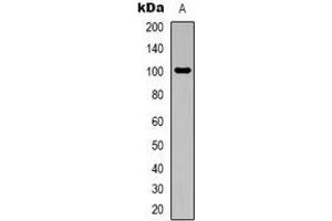Western blot analysis of Aconitase 1 expression in Hela (A) whole cell lysates.