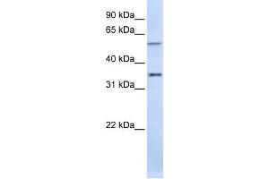WB Suggested Anti-TJAP1 Antibody Titration:  0. (TJAP1 anticorps  (C-Term))