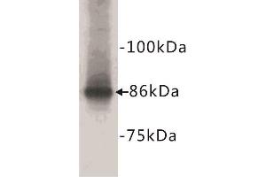 Western Blotting (WB) image for anti-Catenin, beta (CATNB) (N-Term) antibody (ABIN1854847) (beta Catenin anticorps  (N-Term))
