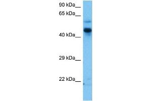 Host:  Mouse  Target Name:  ZIC3  Sample Tissue:  Mouse Brain  Antibody Dilution:  1ug/ml (ZIC3 anticorps  (N-Term))
