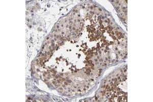 Immunohistochemical staining of human testis with GLCCI1 polyclonal antibody  shows distinct cytoplasmic positivity in primary spermatocytes in seminiferus ducts at 1:50-1:200 dilution. (GLCCI1 anticorps)