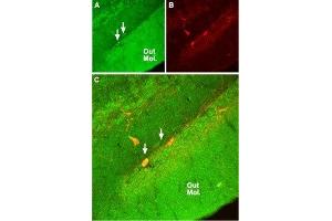 Expression of NR2A in rat hippocampus - Immunohistochemical staining of rat hippocampal dentate gyrus with Anti-NMDAR2A (GluN2A) (extracellular) Antibody (ABIN7043228, ABIN7044324 and ABIN7044325).