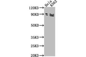 Western Blot Positive WB detected in: Hela whole cell lysate, K562 whole cell lysate All lanes: SUPV3L1 antibody at 1:2000 Secondary Goat polyclonal to rabbit IgG at 1/50000 dilution Predicted band size: 88 kDa Observed band size: 88 kDa (SUPV3L1 anticorps  (AA 499-786))