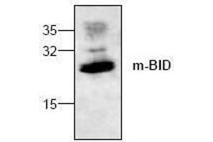 Image no. 1 for anti-BH3 Interacting Domain Death Agonist (BID) antibody (ABIN127071) (BID anticorps)