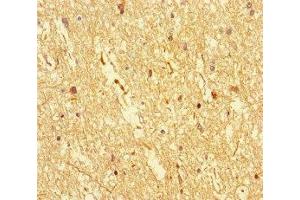 Immunohistochemistry of paraffin-embedded human brain tissue using ABIN7149587 at dilution of 1:100 (DOCK3 anticorps  (AA 1630-1934))