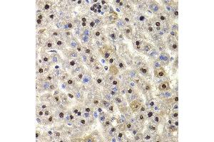 Immunohistochemistry of paraffin-embedded rat liver using HIRIP3 antibody at dilution of 1:100 (x400 lens). (HIRIP3 anticorps)