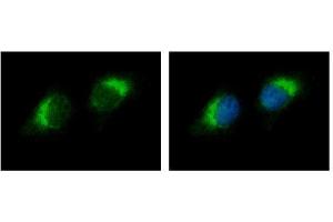 ICC/IF Image Ribonuclease A antibody detects RNASE1 protein at cytoplasm by immunofluorescent analysis. (RNASE1 anticorps  (Center))