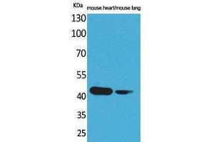 Western Blotting (WB) image for anti-Actin, Alpha, Cardiac Muscle 1 (ACTC1) (N-Term) antibody (ABIN3180981)