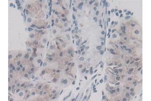 Detection of CYPA in Human Stomach Tissue using Monoclonal Antibody to Cyclophilin A (CYPA)