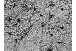Adult rat hippocampus immunohistochemistry. (ALDH1L1 anticorps  (AA 1-902))