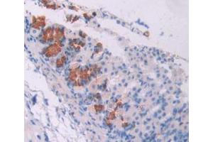IHC-P analysis of Mouse Stomach Tissue, with DAB staining. (Oncostatin M anticorps  (AA 116-205))