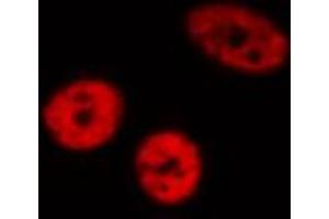 ABIN6272437 staining HeLa by IF/ICC. (ZNF280A anticorps  (C-Term))