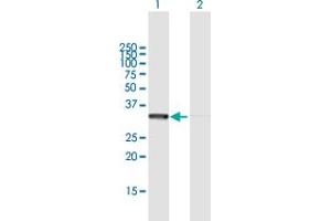 Western Blot analysis of RPLP0 expression in transfected 293T cell line by RPLP0 MaxPab polyclonal antibody. (RPLP0 anticorps  (AA 1-317))