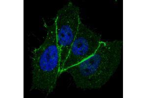 Fluorescent confocal image of MCF7 cells stained with phospho-ERBB2- antibody.