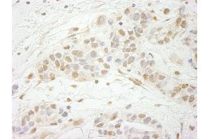 Immunohistochemistry (IHC) image for anti-Metastasis Associated 1 Family, Member 3 (MTA3) (AA 400-450) antibody (ABIN7448677)