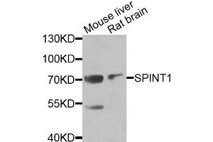 Western blot analysis of extracts of various cell lines, using SPINT1 antibody (ABIN5973812) at 1/1000 dilution. (SPINT1 anticorps)