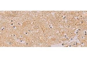 Immunohistochemistry of paraffin-embedded Human brain tissue using PTPRN Polyclonal Antibody at dilution of 1:55(x200)