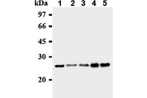 Western Blotting (WB) image for anti-MAD2 Mitotic Arrest Deficient-Like 1 (Yeast) (MAD2L1) antibody (ABIN567786)