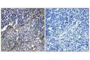 Immunohistochemistry analysis of paraffin-embedded human thymus gland tissue using Collagen XIX α1 antibody.